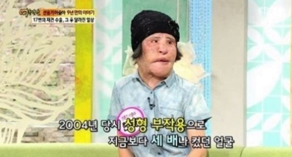 ‘선풍기 아줌마’ 한혜경씨 별세… 향년 57세