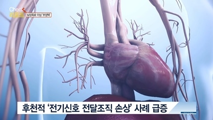 [쿠키건강뉴스-체크리포트] “정상 심장박동 되찾아도 부정맥 원인은 몸속에 남아”…치명적 합병증 막으려면 위험요인 관리 중요