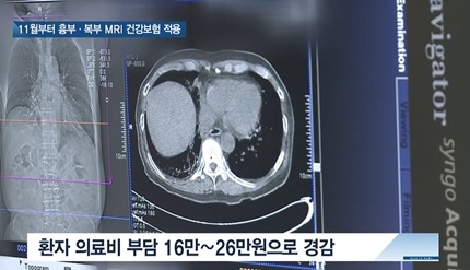 [쿠키건강뉴스] 11월부터 흉부·복부 MRI 건강보험 적용…환자 부담 3분의1로 줄어