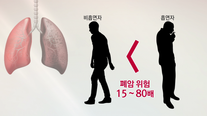[글로벌 명의 명클리닉] 폐암수술 전문 문석환 서울성모병원 흉부외과 교수