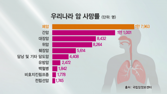 [글로벌 명의 명클리닉] 폐암수술 전문 문석환 서울성모병원 흉부외과 교수