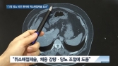 [쿠키건강뉴스] “1형 당뇨 고도비만 환자에 위소매절제술 효과적”