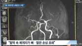 [쿠키건강뉴스] “뼈 약해지면 뇌혈관 위험”…뇌졸중 환자 61%, 골밀도 저하