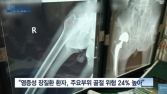 [쿠키건강뉴스] “염증성장질환 환자, 척추·고관절 골절 위험 더 높아”