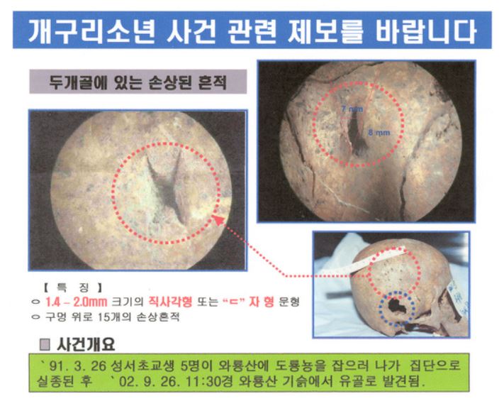 개구리소년 살해 도구는 '버니어캘리퍼스' …진범은 동네 일진”